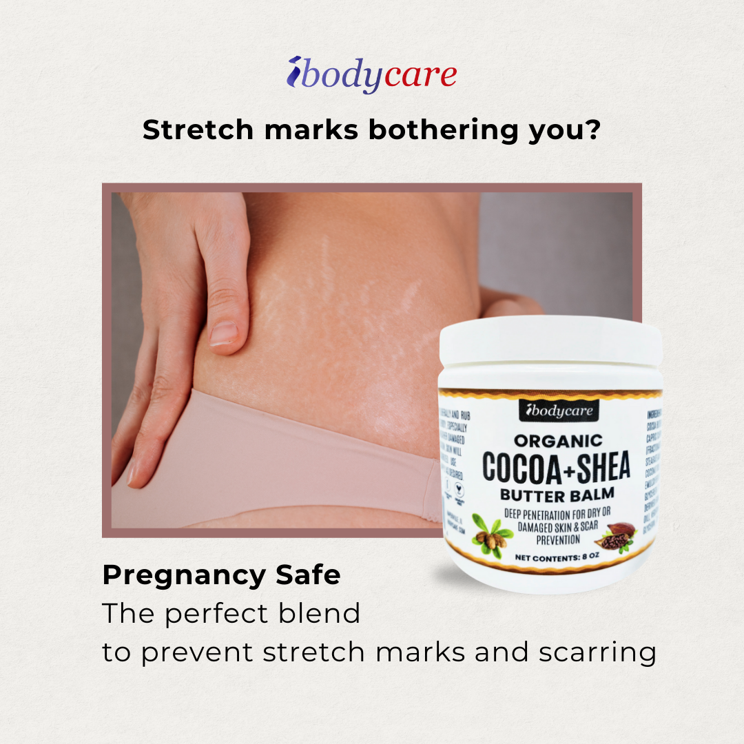 cocoa + shea butter body balm for stretch marks scarring and to prevent stretch