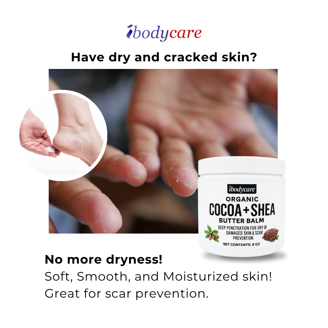 ibodycare cocoa shea butter organic body balm for scars and stretch marks paraben free 8 oz